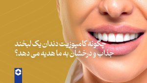 مزایای کامپوزیت دندان و تاثیر آ» بر زیبایی دندان