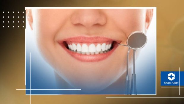 مراقبت‌های بعداز مراحل ایمپلنت دندان